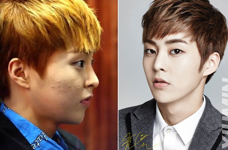 Khuôn mặt của nam ca sĩ Xiumin nhóm EXO có nhiều mụn sần sùi thế nào thì có bàn tay của photoshop nó lại nuột nà, mịn màng như da em bé.